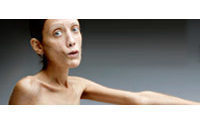 Italie : publicité choc d'Oliviero Toscani contre l'anorexie
